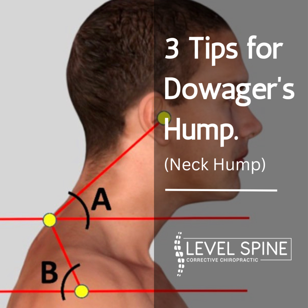 BETTER POSTURE: HOW TO GET RID OF A Dowager's Hump